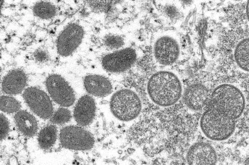 This 2003 electron microscope image made available by the Centers for Disease Control and Prevention shows mature, oval-shaped monkeypox virions, left, and spherical immature virions, right, obtained from a sample of human skin associated with the 2003 prairie dog outbreak. British health officials said Monday, June 13, 2022 they have detected another 104 cases of monkeypox in England, in what has become the biggest outbreak beyond Africa of the normally rare disease.   (Cynthia S. Goldsmith, Ru