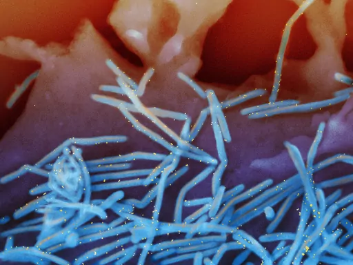 This electron microscope image provided by the National Institutes of Health shows human respiratory syncytial virus (RSV) virions, colorized blue, and anti-RSV F protein/gold antibodies, colorized yellow, shedding from the surface of human lung cells. Americans 60 and older can get a new RSV vaccine but should discuss it with their doctor first, U.S. health officials recommended Thursday, June 29, 2023. (National Institute of Allergy and Infectious Diseases, NIH via AP, File)