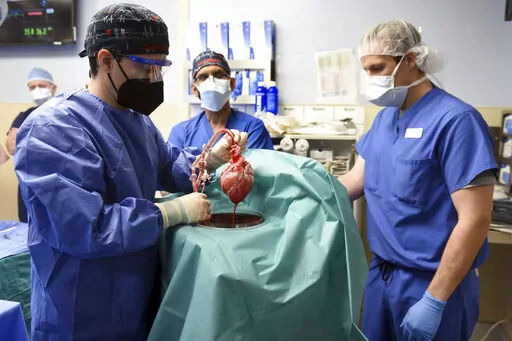 In this photo provided by the University of Maryland School of Medicine, members of the surgical team show the pig heart for transplant into patient David Bennett in Baltimore on Friday, Jan. 7, 2022. Researchers trying to learn what killed Bennett, the first person to receive a heart transplant from a pig, have discovered signs of an animal virus in the organ but cannot yet say if it played any role in the man’s death. (Mark Teske/University of Maryland School of Medicine via AP, File)