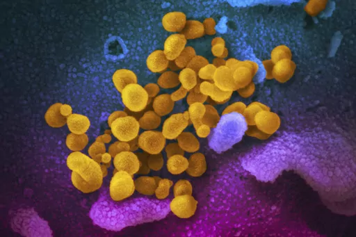 This undated, colorized electron microscope image made available by the U.S. National Institutes of Health in February 2020 shows the Novel Coronavirus SARS-CoV-2, indicated in yellow, emerging from the surface of cells, indicated in blue/pink, cultured in a laboratory. The National Institutes of Health is opening a handful of studies to start testing possible treatments for long COVID, an anxiously awaited step in U.S. efforts against the mysterious condition. The announcement, Monday, July 31,