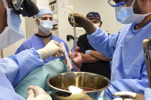 CORRECTS BYLINE TO MARK TESKE, NOT DEBORAH KOTZ - In this photo provided by the University of Maryland School of Medicine, surgeons prepare for a pig heart transplant into Lawrence Faucette at the school's hospital in Baltimore, Md., in September 2023. Two days after the transplant, Faucette was cracking jokes and able to sit in a chair, doctors said Friday, Sept. 22, 2023. (Deborah Kotz/University of Maryland School of Medicine via AP)